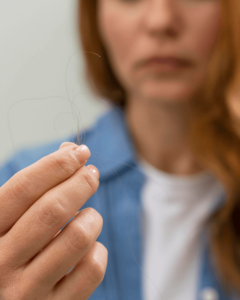 vitamina d e a queda capilar